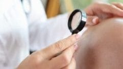 Indenização por Erro em Cirurgia de Calvície Decisão Judicial no Distrito Federal
