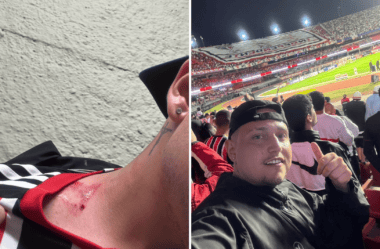 "Cena muito feia", diz torcedor atingido por placa metálica no Morumbis | são paulo